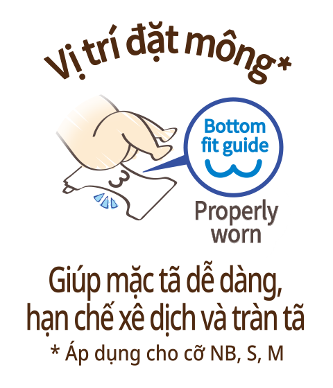 Vị tr&iacute; đặt m&ocirc;ng